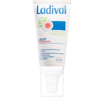 Ladival AKUT ser regenerator dupa expunerea la soare Ladival AKUT ser regenerator dupa expunerea la soare
