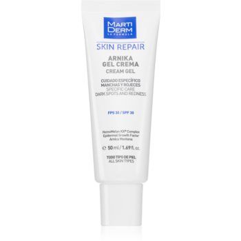 MartiDerm Skin Repair gel crema impotriva petelor intunecate